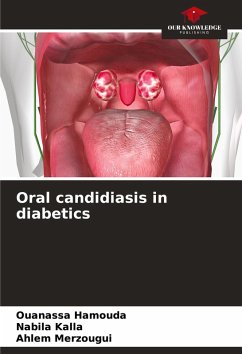 Cover Oral candidiasis in diabetics