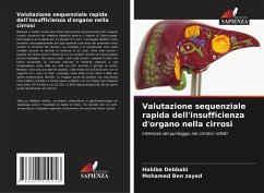 Cover Valutazione sequenziale rapida dell'insufficienza d'organo nella cirrosi