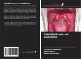 Candidiasis oral en diabéticos Candidiasis oral en diabéticos