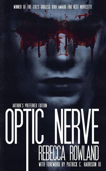 Optic Nerve Optic Nerve