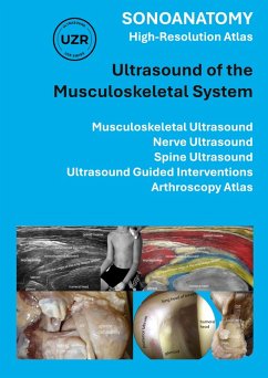 Sonoanatomy - High-Resolution Atlas - Ultrasound of the Musculoskeletal System Cover Sonoanatomy - High-Resolution Atlas - Ultrasound of the Musculoskeletal System