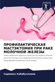 PROFILAKTIChESKAYa MASTJeKTOMIYa PRI RAKE MOLOChNOJ ZhELEZY PROFILAKTIChESKAYa MASTJeKTOMIYa PRI RAKE MOLOChNOJ ZhELEZY