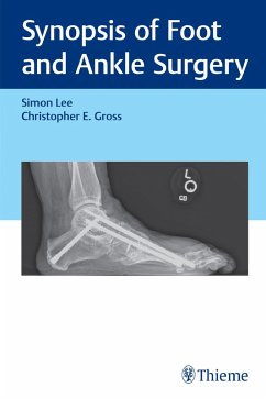 Cover Synopsis of Foot and Ankle Surgery (eBook, ePUB)