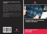Imagiologia da trombose venosa cerebral
