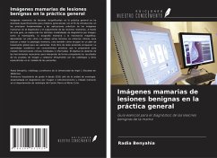 Cover Imágenes mamarias de lesiones benignas en la práctica general