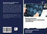 Vizualizaciq cerebral'nyh wenoznyh trombozow