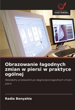 Obrazowanie ¿agodnych zmian w piersi w praktyce ogólnej - BENYAHIA, Radia