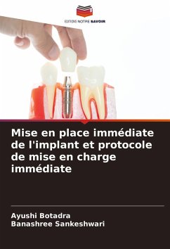 Cover Mise en place immédiate de l'implant et protocole de mise en charge immédiate