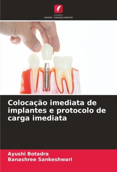 Cover Colocação imediata de implantes e protocolo de carga imediata
