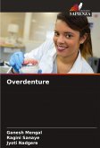 Overdenture