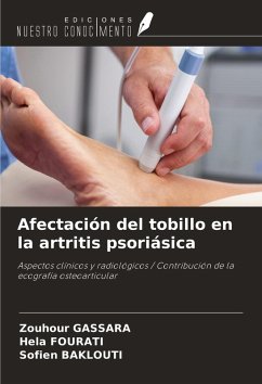 Cover Afectación del tobillo en la artritis psoriásica