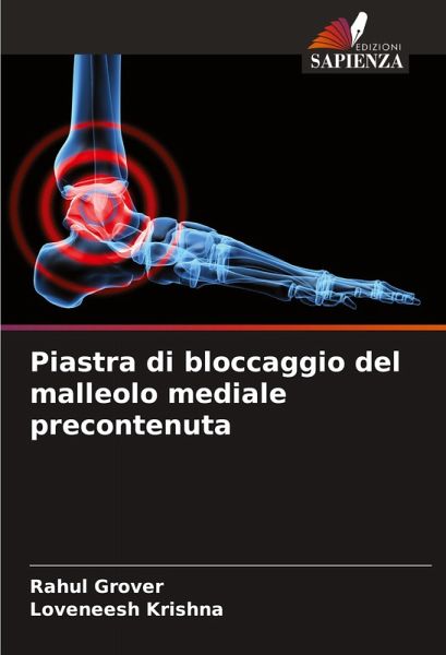 Piastra di bloccaggio del malleolo mediale precontenuta Piastra di bloccaggio del malleolo mediale precontenuta