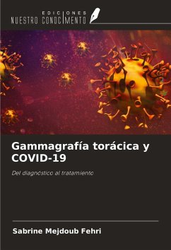 Gammagrafía torácica y COVID-19 - Mejdoub Fehri, Sabrine