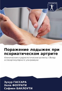 Cover Porazhenie lodyzhek pri psoriaticheskom artrite