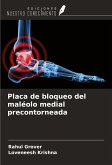Placa de bloqueo del maléolo medial precontorneada