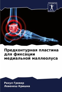 Cover Predkonturnaq plastina dlq fixacii medial'noj malleolusa