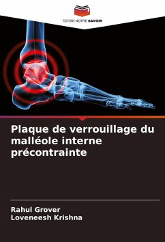 Cover Plaque de verrouillage du malléole interne précontrainte