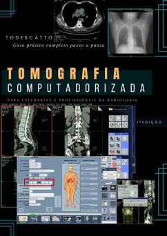 Cover Livro De Tomografia Computadorizada (eBook, PDF)
