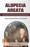 Alopecia Areata