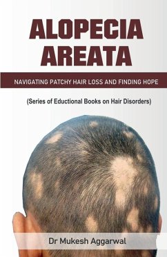 Alopecia Areata - Hair Loss, Navigating Patchy