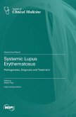 Systemic Lupus Erythematosus Systemic Lupus Erythematosus