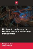 Utilização de lasers de tecidos duros e moles em Periodontia