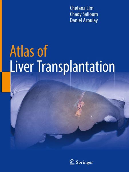 Atlas of Liver Transplantation