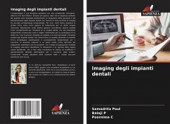 Imaging degli impianti dentali - Paul, Samadrita;P, Balaji;C, Poornima