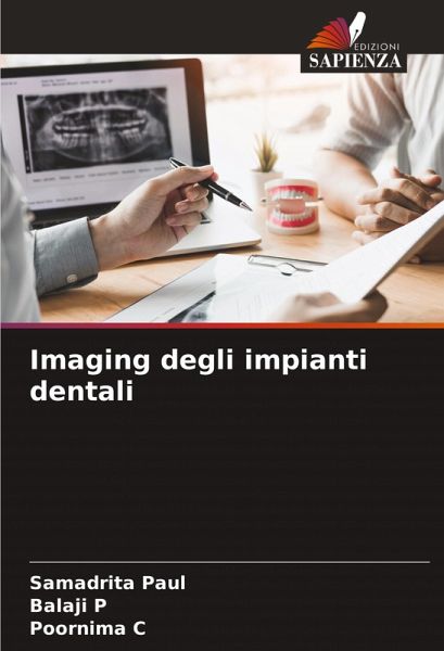 Imaging degli impianti dentali