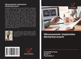 Obrazowanie implantów dentystycznych