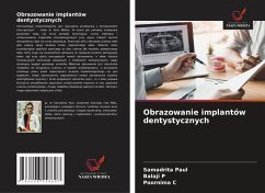 Cover Obrazowanie implantów dentystycznych