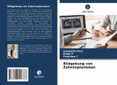 Bildgebung von Zahnimplantaten Bildgebung von Zahnimplantaten