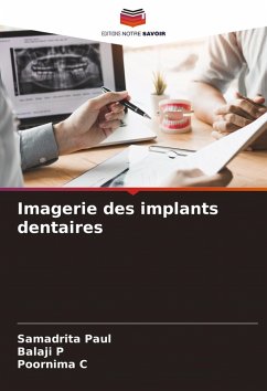 Cover Imagerie des implants dentaires
