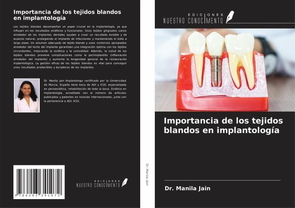 Importancia de los tejidos blandos en implantología Importancia de los tejidos blandos en implantología