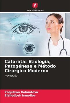 Cover Catarata: Etiologia, Patogénese e Método Cirúrgico Moderno