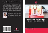 Importância dos tecidos moles na implantodontia Importância dos tecidos moles na implantodontia