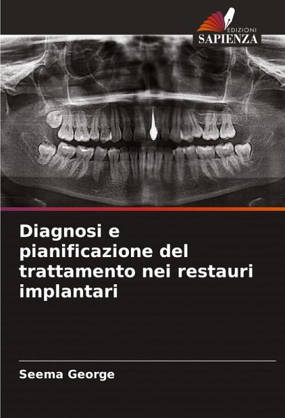 Diagnosi e pianificazione del trattamento nei restauri implantari Diagnosi e pianificazione del trattamento nei restauri implantari
