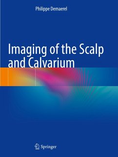 Imaging of the Scalp and Calvarium - Demaerel, Philippe