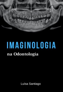 Imaginologia Na Odontologia (eBook, PDF) - Santiago, Luísa