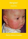 Alergias! (eBook, PDF)