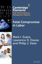 Fetal Compromise in Labor - Devoe, Lawrence D.; Evans, Mark I.; Steer, Philip J.