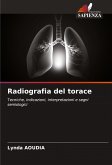 Radiografia del torace Radiografia del torace