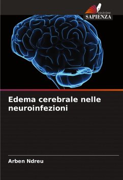 Cover Edema cerebrale nelle neuroinfezioni
