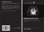 Radiografía de tórax