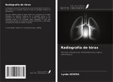 Radiografía de tórax Radiografía de tórax