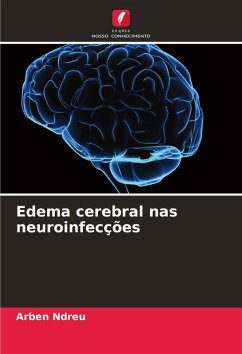 Cover Edema cerebral nas neuroinfecções