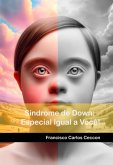 Síndrome De Down: Especial Igual A Você! (eBook, PDF)