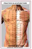 Practic In Acupuncture (eBook, PDF) Practic In Acupuncture (eBook, PDF)