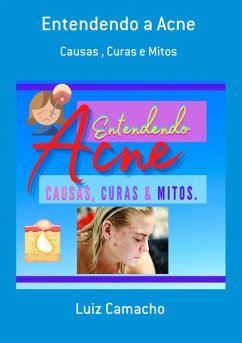 Cover Entendendo A Acne (eBook, PDF)