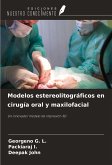 Modelos estereolitográficos en cirugía oral y maxilofacial